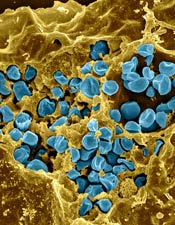 View through microscope of tularemia, tan cratered surface covered with small blue clumps