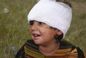 Young child with head wrapped in white gauze bandage