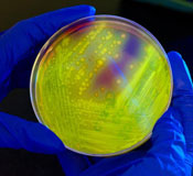 Close up of petri dish glowing bright yellow glow held by gloved hands