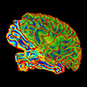 Colorful image of brain scan