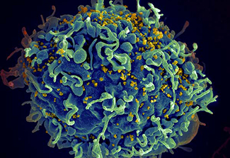 Photo of HIV infecting human cell