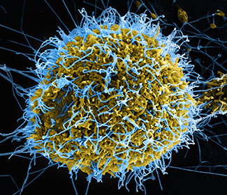 This is a colorized scanning electron micrograph of filamentous Ebola virus particles (blue) budding from a chronically infected VERO E6 cell (yellow-green)