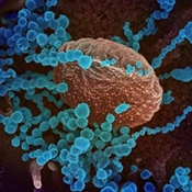 SARS-CoV-2 (round blue objects) emerges from the surface of cells the virus depicted here was isolated from a patient in the U.S.