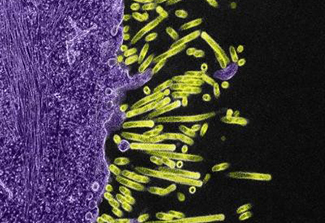 Swine flu virus particles (green) attach to and bud from the surface of a cell (purple)