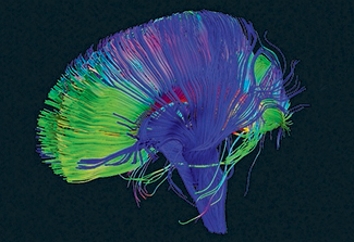 The illustration on this page highlights the brain's neural pathways in blue, green, yellow and red using tractography.