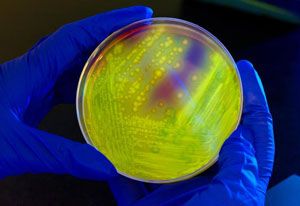 Close up of petri dish glowing bright yellow glow held by gloved hands