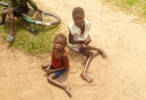 Two crippled African children seated on ground in dirt with very thin, awkwardly angled legs