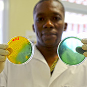 The photograph shows a man holding up two petri dishes at the National Laboratory in Port-au-Prince, Haiti. The dish on the left has a yellow appearance, indicating a positive result for the vibrio cholera bacteria. The dish on the right appears blue green.