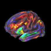 A functional MRI (fMRI) image of preteen brain with areas of the brain appearing in blue red, purple, green and yellow.  The regions in yellow and red are the most active.