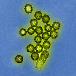 This artistic rendering of a microscopic view of influenza viruses shows the many stalks and heads on the surfaces in green and yellow.
