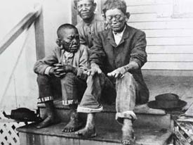 Black and white photo of three boys in leprosy colony, sores on faces and hands