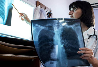 Dr. Lali Mikishivili reviews a TB patient's x-ray at the Georgian National Center for Tuberculosis and Lung Disease.