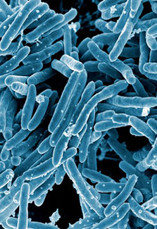 Scanning electron micrograph of Mycobacterium tuberculosis bacteria, which cause tuberculosis.