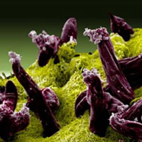 View through microscope of plasmodium gallinaceum, dark purple tubes growing from light green textured surface