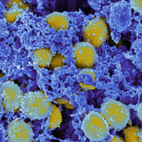 Microscopic image of staph bacteria: yellow balls surrounded by purple filler on black background