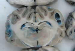 Bisected pig brains laid out side by side, mostly grey with some blue dyed areas throughout