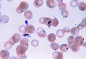 View of Plasmodium falciparum under microscope, small scattered purple circles