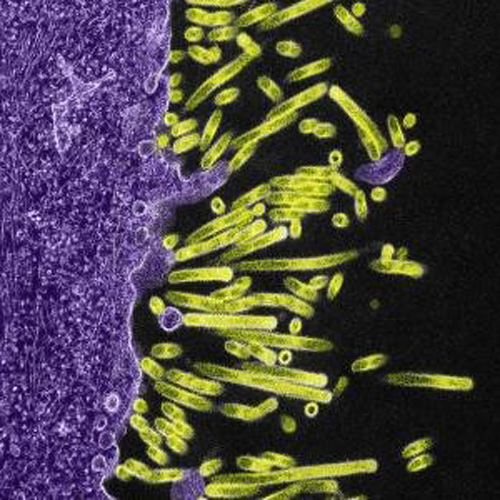 Swine flu virus particles (green) attach to and bud from the surface of a cell (purple)