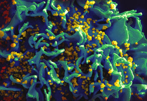 Microscopic image of HIV infecting human t-cell, light blue rose pattern covered with mustard yellow dots, on black background