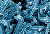 Scanning electron micrograph of Mycobacterium tuberculosis bacteria, which cause tuberculosis.