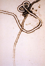 Electron micrograph of the eboal virus