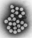 Photo: Negative-Stain Electron Micrograph of Rotavirus A
