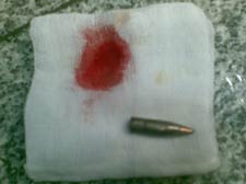 Close up of bullet resting on medical gauze with round bright red blood stain