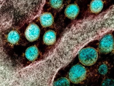 Transmission electron microscope image shows SARS-CoV-2. Courtesy of NIAID.