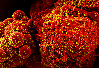 A colorized scanning electron micrograph of a cell (red) infected with the Omicron strain of SARS-CoV-2 virus particles (yellow), isolated from a patient sample.