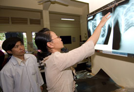 Woman compares two chest xrays on light board, man behind her observes