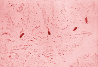 The image is a salmon-colored specimen where four flagellated Vibrio cholerae bacteria are clearly visible.