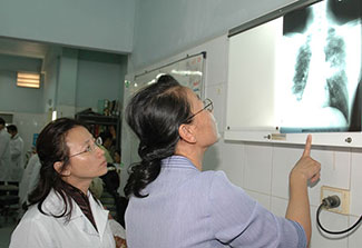 Two female medical workers examine a chest x-ray on a lightboard on the wall of a medical facility
